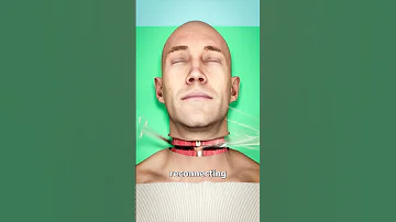 Full Body Transplant Explained 