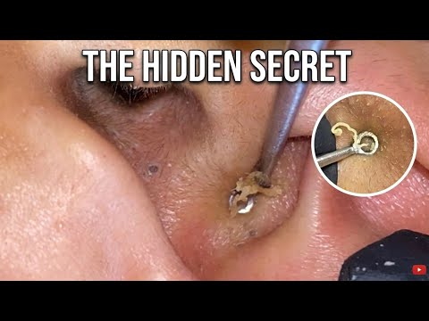 Ultimate Ear/Skin Extraction Challenge! (Exclusive Extended Cuts)