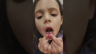 Roguess 1St Loose Tooth 112024