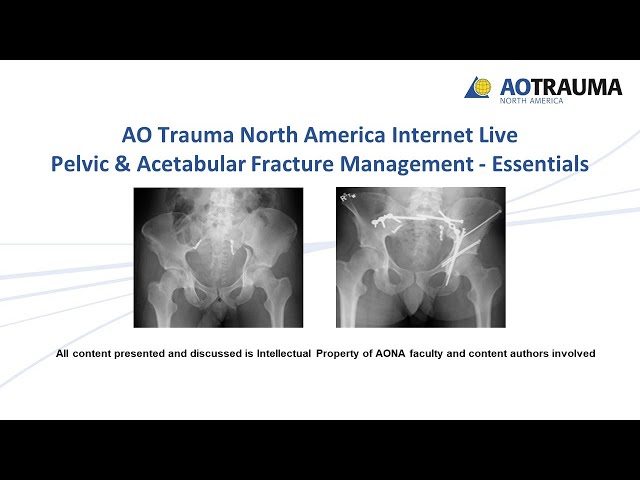 Pelvic & Acetabular Fracture Management Essentials Week 8 - YouTube