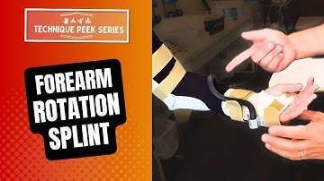 How to Create a Static Progressive Forearm Rotation Splint  |  Technique Peek Series