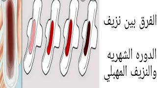 الفرق بين الدوره الشهريه والنزيف المهبلي/أسباب النزيف المهبلي