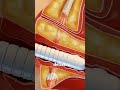 What is V-Tone Procedure and How It Works? (3D Animation)#vtonesurgery #rejuvination #tightening #