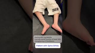 Spina Bifida Physiotherapy Management
