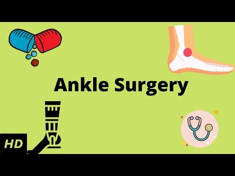 Ankle Surgery: Everything You Need to Know