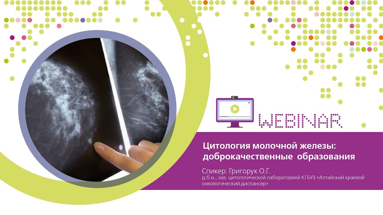 Цитология молочной железы: доброкачественные образования