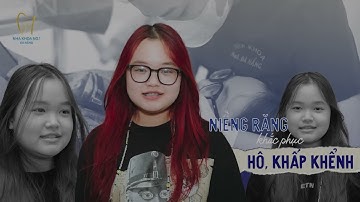 Gắn mắc cài cho khách hàng niềng răng khấp khểnh lệch lạc tại nha khoa NO1 Đà Nẵng.