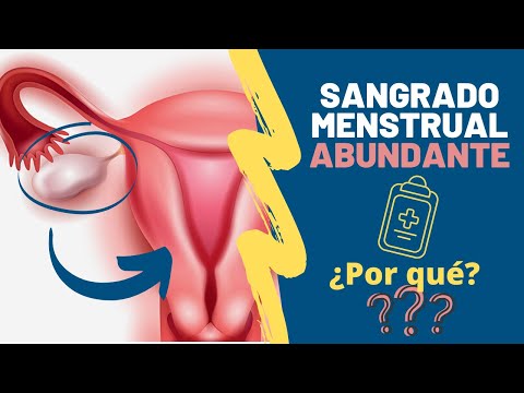 Vídeo: Sangrado Abundante Y Profuso Durante La Menstruación, Con Coágulos, ¿qué Hacer?