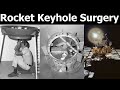 How NASA's Apollo 14 Fixed A Critical Problem Using 'Keyhole Rocket Surgery'
