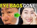 Tighten Puffy Under-Eye Bags & Fade Dark Circles — No Surgery Needed