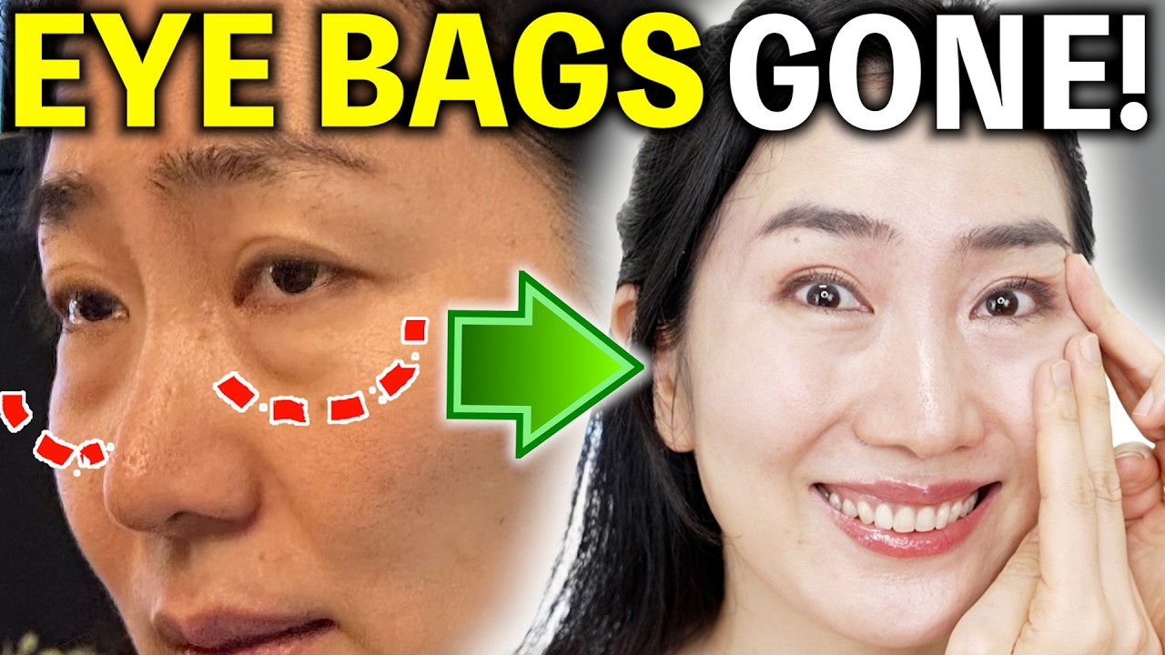 Tighten Puffy Under-Eye Bags & Fade Dark Circles — No Surgery Needed