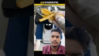 Kurkure Under The Microscope 😱 || #shorts #viralvideo  #youtubeshorts #microscope