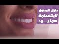 كيف تصل إلى هوليود سمايل المناسبة لك مع الدكتور أحمد القفاص