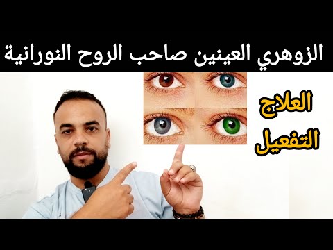 الزوهري العينين صاحب العين النورانية علاجه وتفعيله