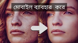 Spot Removing & Skin Smoothing Using Android Phone | Bangla Snapseed Tutorial screenshot 2