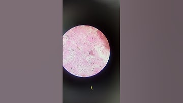 Amoeba by Microscope #subscribe #viral #viralvideo #trending #shorts #mahamayaclasses