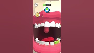 Dentist Bling - Gameplay Android,ios 👨‍⚕️👩‍⚕️All Levels 04