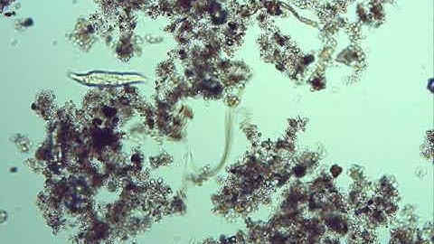 Nematode &  Rotifer in Compost Tea @ 100x Magnification