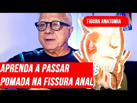 Fissura:Aprendam passar pomada manipulação fissura anal certa no local certo e seu efeito colateral.