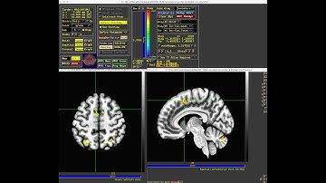 fMRIPrep Tutorial #6: Scripting and Group Analysis