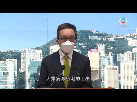 港大團隊獲食衞局資助研究了解污水中檢測新冠病毒情況