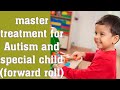 special child के लिये Master treatment..autism.CP,MR,ADHD, बच्चों के लिए वरदान.8368871112,9911335657