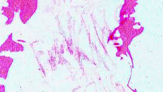 FEISTLING & Killin' Void - THIS F**KING SONG