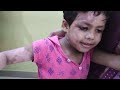 Safed Daag  Bacho Mae Ilaj Hota Hai.8867239831