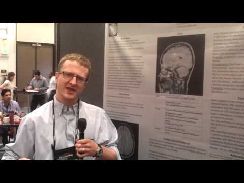 Dr Patrick Wood: Fahr&rsquo;s disease, brain calcification in SLE