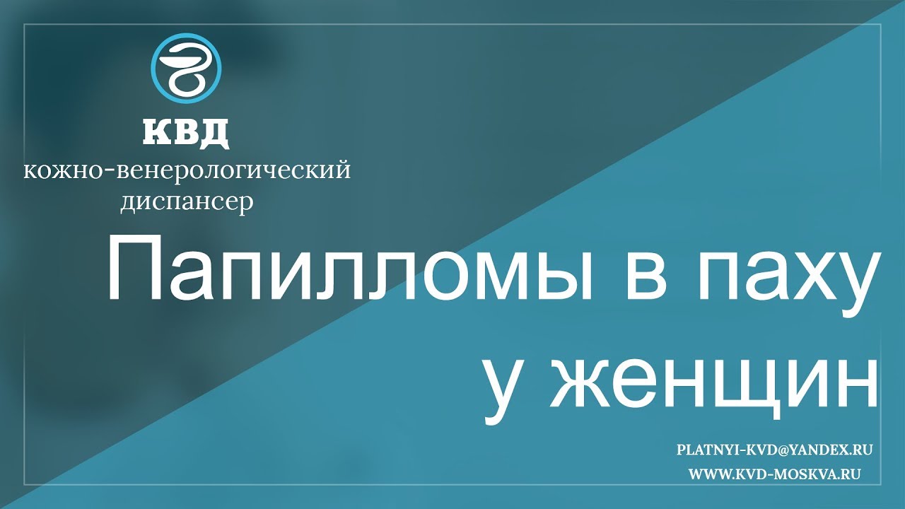 626 Папилломы в паху у женщин