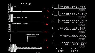 MRI: Physics and Image Creation - Phase Encoding 1D Example (Part 17/18)