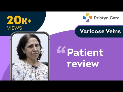Varicose veins Patient reviews