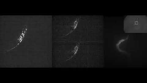 Whole-brain activity imaging of free-moving worm