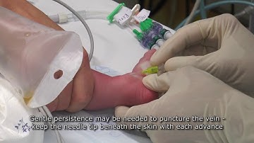 Paediatric Anaesthetics: Chapter 7 - Long saphenous IV neonate 1