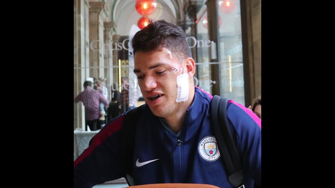 Ederson arrives back at Manchester hotel with bandaged face after kick