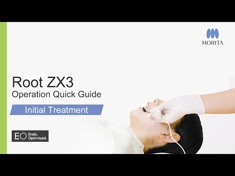 ITI Treatment Guide 1,2,3 日本語版 シエン社 | ITI Treatment Guide [Volume 14]