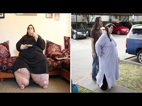 Amber Rachdi Loses 280lb Body Weight after Hitting 657lb