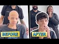 He helps kids regain their self-esteem by providing hair implants.