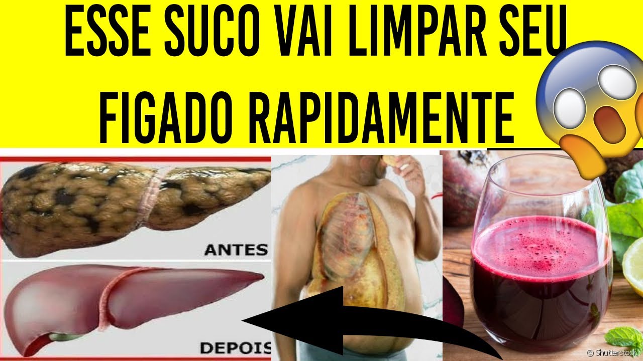Como Eliminar Gordura No Figado Rapido