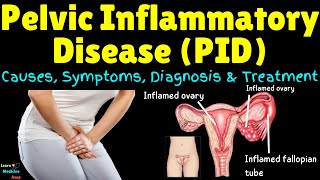 Pelvic Inflammatory Disease (PID) – Symptoms, Causes, Diagnosis, Treatment - Gynecology