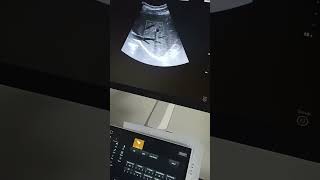 Doppler Ultrasound Diagnostic System US-C8D Cardiac Imaging Demonstration Video. Doppler Ultrasound Diagnostic System US-C8D Cardiac Imaging Demonstration Video.