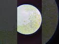 Chlorella under microscope! #algae #citizenscience #tinkering #biofuel #biotechnology #microscope