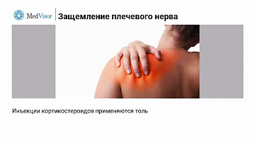 Что делать, если защемило нерв в плече?