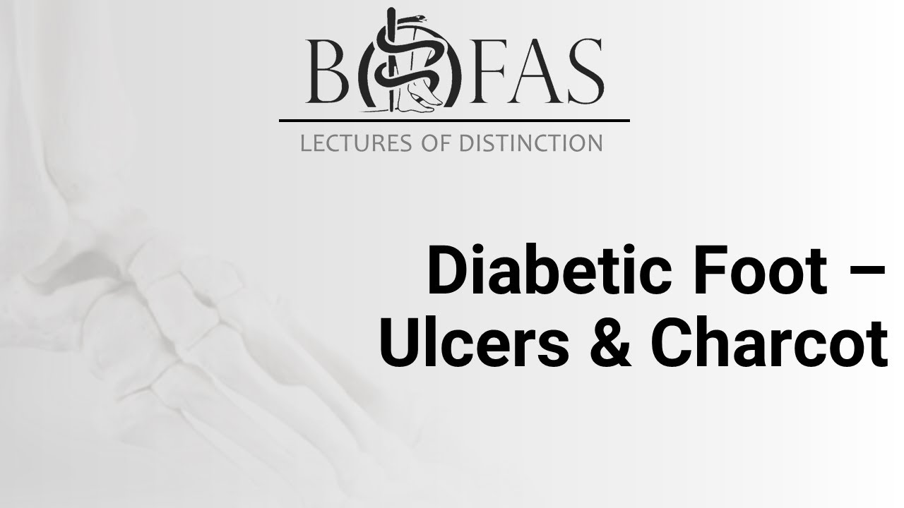 Diabetic Foot – Ulcers & Charcot – BOFAS Lectures of Distinction Diabetic Foot – Ulcers & Charcot – BOFAS Lectures of Distinction