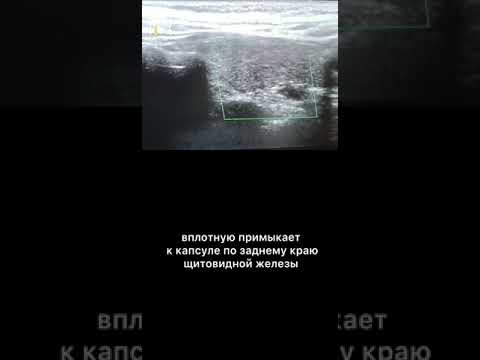 3 августа 2024 г.