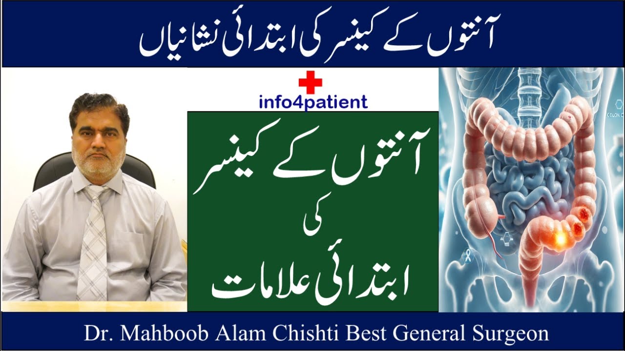 آنتوں کے کینسر کی ابتدائی نشانیاں | Symptoms of Colon Cancer | Dr. Mahboob Alam Chishti