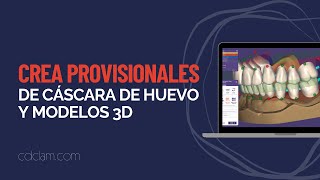 Create Eggshell Temporarys and 3D Models tailored to your design like a PRO EXOCAD!