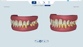 ✨ Orthodontic Simulation with Helios700 ✨