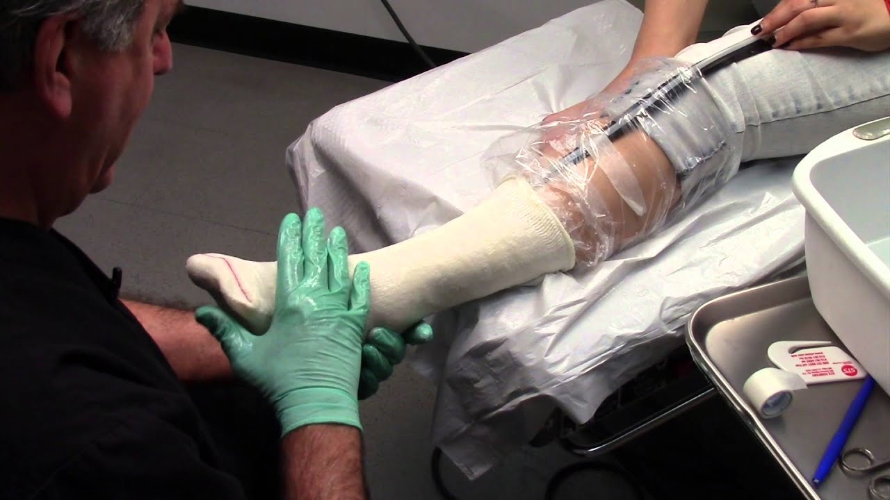 STS Sock AFO Casting Technique YouTube