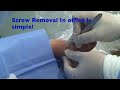 Screw removal from the foot